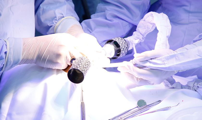 Navigation Technology in Dental Implant Surgery Within 24H